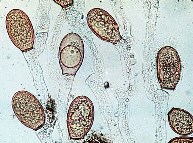 Chytridiomycota