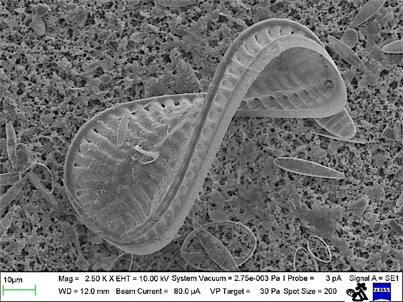 Diatom Surirella spiralis | (MUSE, CC BY-SA 3.0, via Wikimedia Commons)