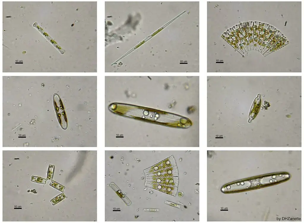 Light microscopy of several species of living freshwater diatoms (Image Source: Damián H. Zanette, Public domain, via Wikimedia Commons)