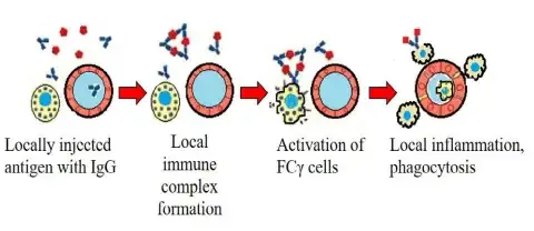 Type – III Hypersensitivity
