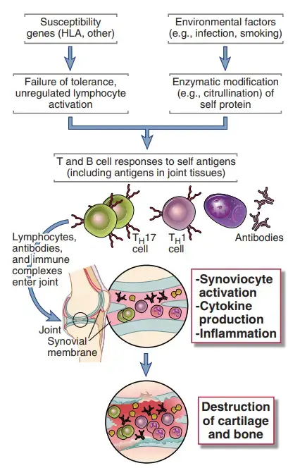 Pathogenesis of Rheumatoid Arthritis
