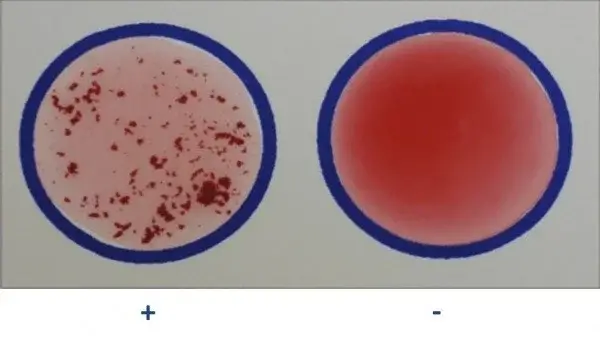  Slide Agglutination test Result