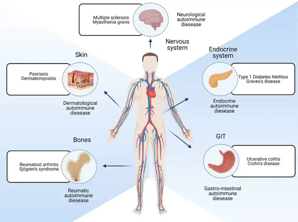 Different locations of the body that are affected by autoimmune diseases.
