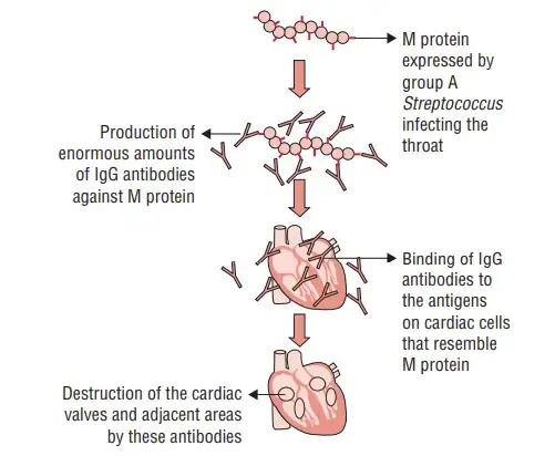 Pathogenesis of acute rheumatic fever
