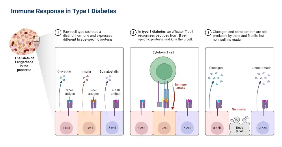 Immune Response in Type I Diabetes
