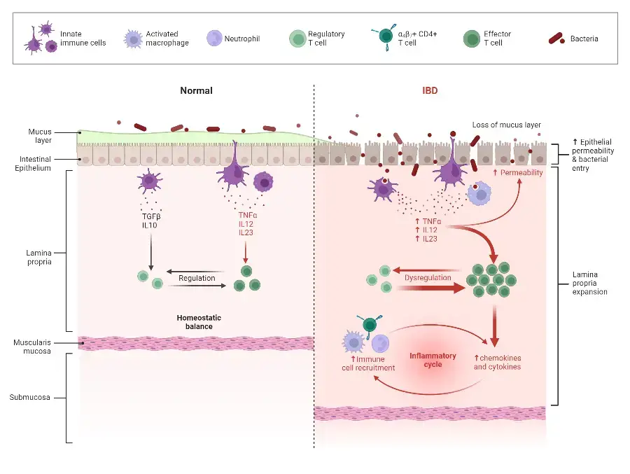 Immune Response in IBD
