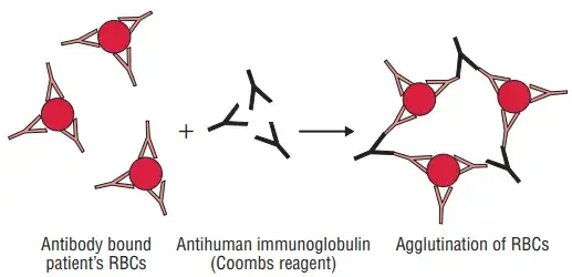 Direct Coombs’ test
