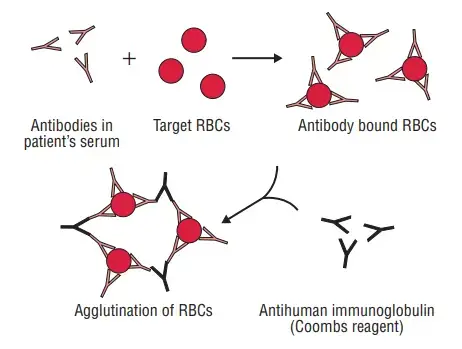 Indirect Coombs’ test
