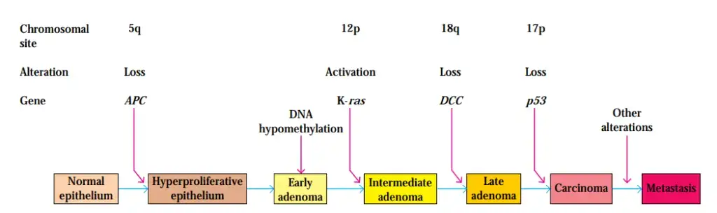 Model of sequential genetic alterations leading to metastatic colon cancer. Each of the stages indicated at the bottom is morphologically distinct, allowing researchers to determine the sequence of genetic alterations. [Adapted from B. Vogelstein and K. W. Kinzler, 1993, Trends Genet. 9:138.]
