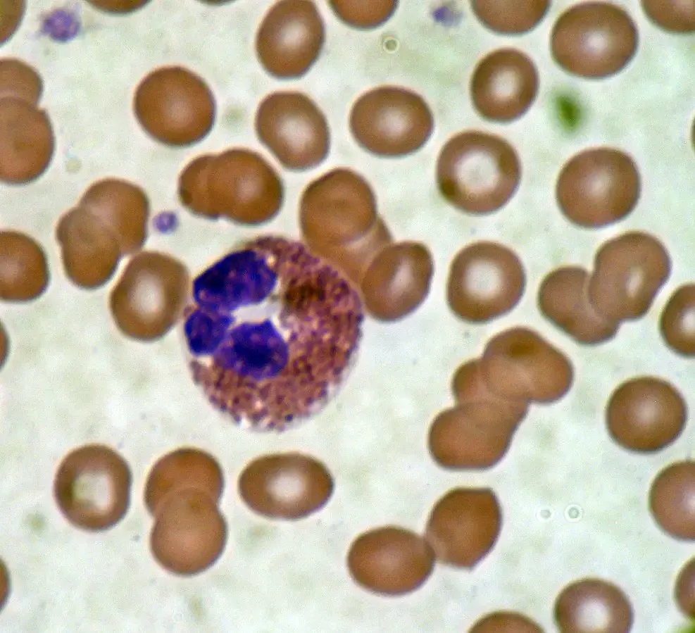 Eosinophil - Definition, Functions, Features, Structure 1 Eosinophil