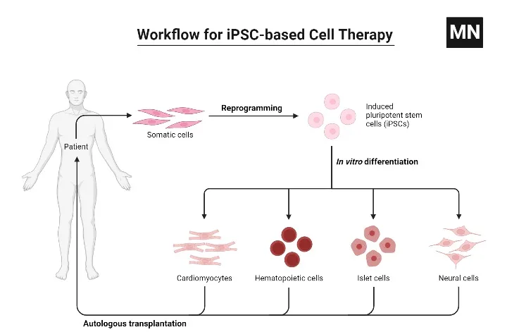 Workflow for iPSC-based Cell Therapy
