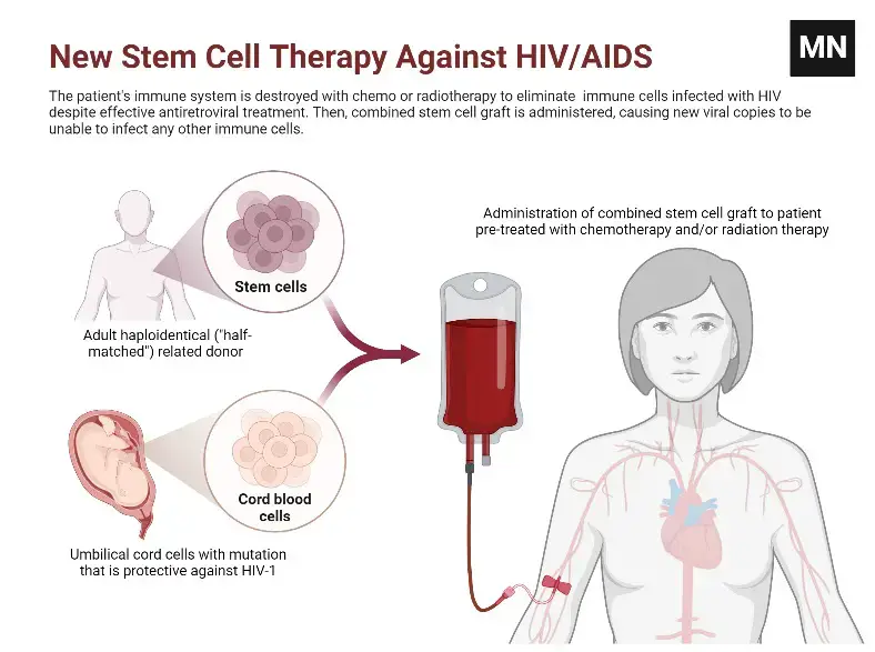 New Stem Cell Therapy Against HIV_AIDS
