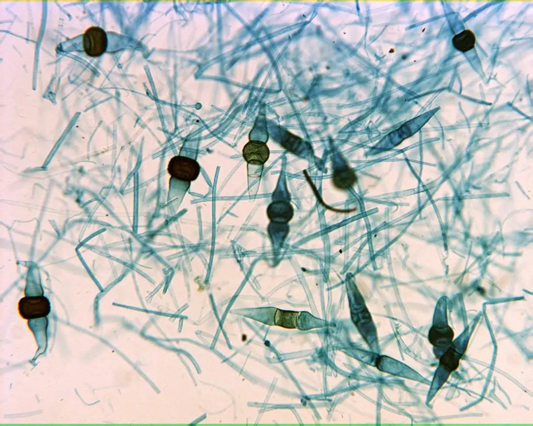 Rhizopus Under Microscope - Biology Notes Online