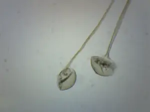Rhizopus Under Microscope
