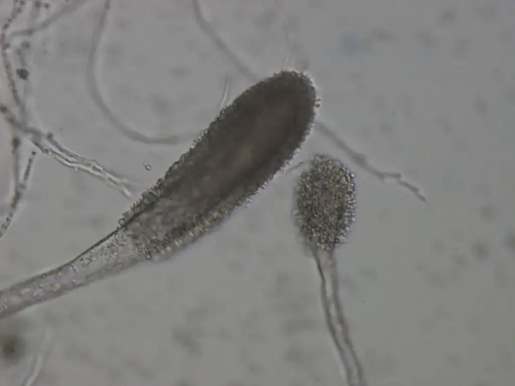 Aspergillus clavatus - Morphology, Life Cycle, Pathogenesis 1 Aspergillus clavatus Conidial Heads