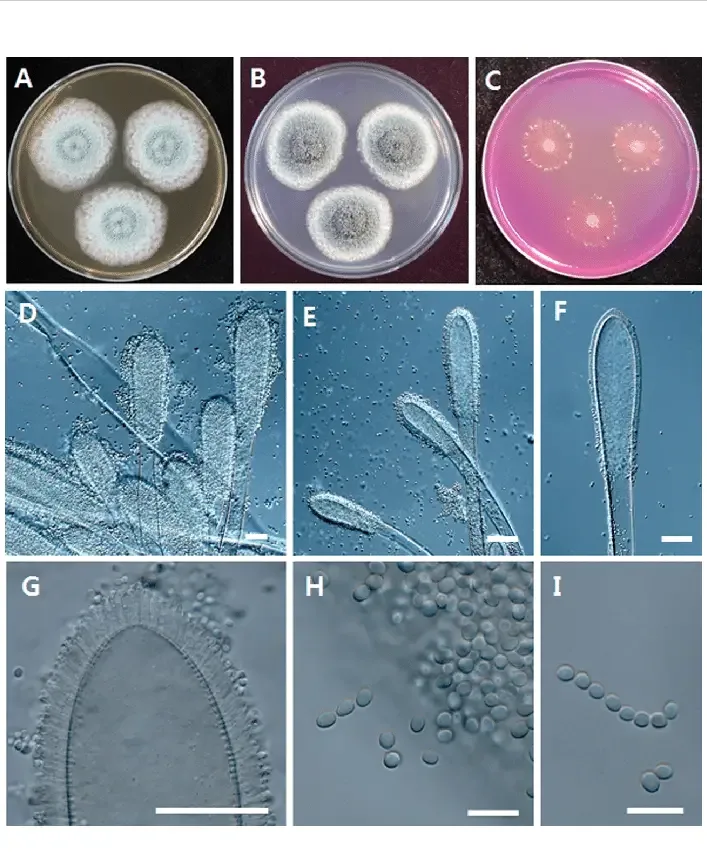 Aspergillus clavatus - Morphology, Life Cycle, Pathogenesis 4 Aspergillus clavatus Y2H0002. A, Colonies on malt extract agar; B, Colonies on Czapek yeast extract agar; C, Colonies on creatine sucrose agar; D~G, Conidiophores and conodia; H~I, Conidia (scale bars: D~G = 40 μm, H, I = 10 μm).