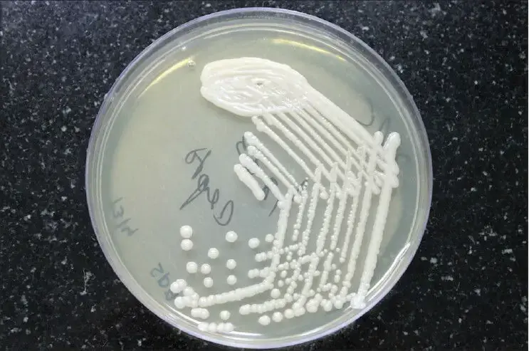 Cryptococcus colonies on Sabroud’s dextrose agar medium
