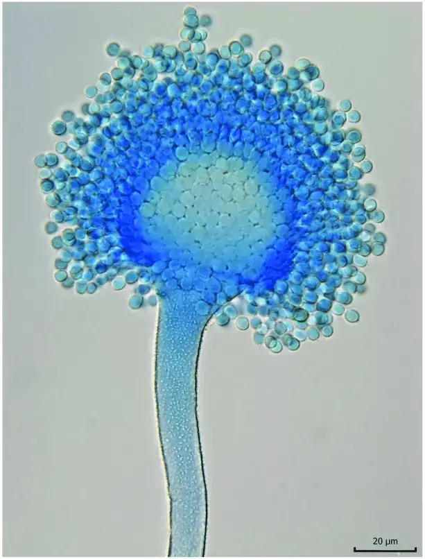 Light microscopy of Aspergillus flavus with lactophenol cotton blue