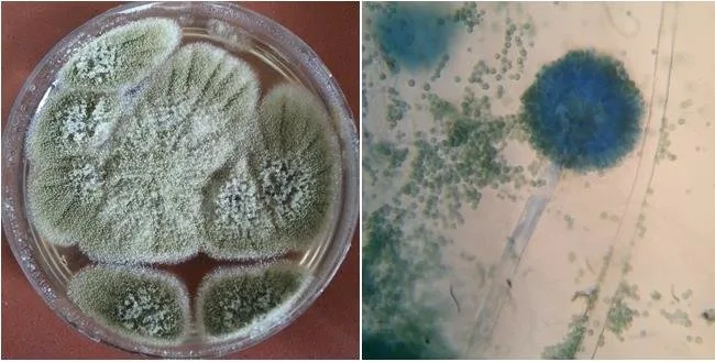 Aspergillus flavus on PDA culture and slide.
