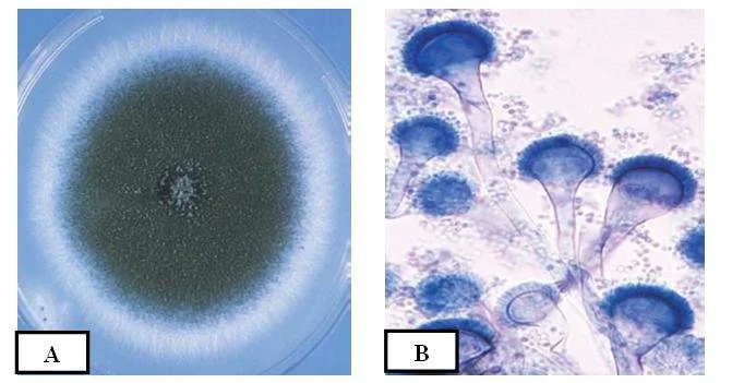 A-Czapek Dox agar culture of A. fumigatus, B-conidial head morphology of A. fumigatus. Note: uniseriate row of phialides on the upper two thirds of the vesicle.
