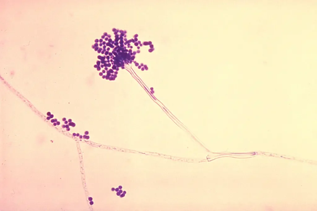 Aspergillus fumigatus Images – Conidia phialoconidia of A. fumigatus
