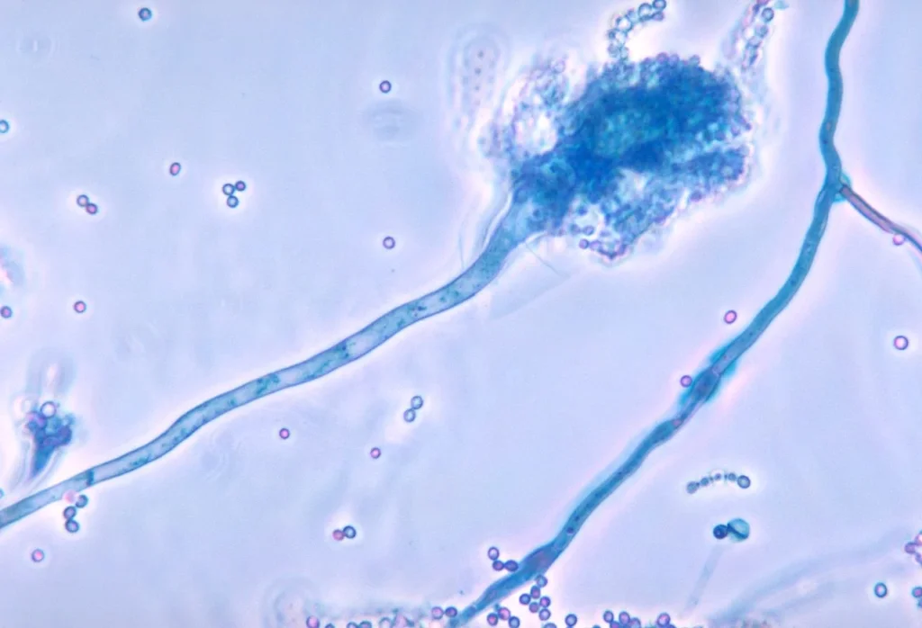 Aspergillus fumigatus Images – The conidiophore of the fungal organism Aspergillus fumigatus
