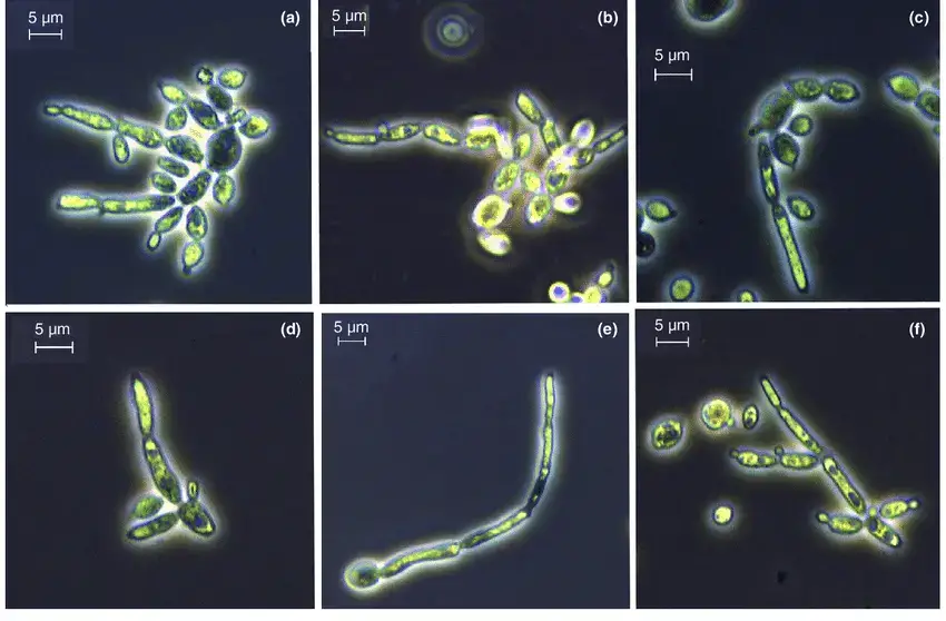 Figure showing pseudo-hypha formation in (a) Candida tropicalis under the influence of Tyr Wa , (b) Candida tropicalis under the influence of self-expressed Tyr Ct , (c) C. tropicalis under the influence of Tyr Sc , (d) C. tropicalis under the influence of standard tyrosol Tyr St , (e) Wickerhamomyces anomalus under the influence of Tyr Ct and (f) W. anomalus under the influence of Tyr St .
