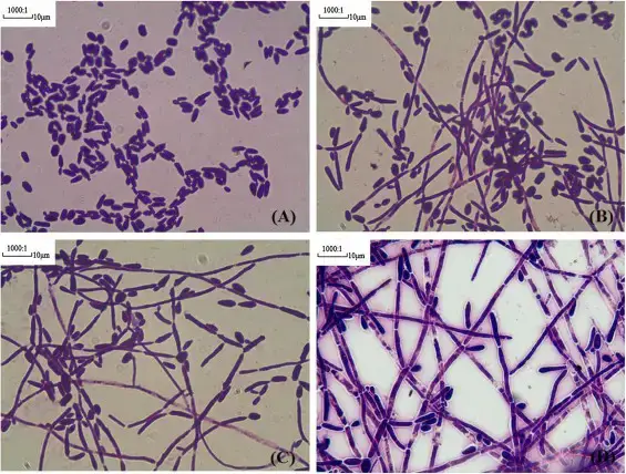 Four classes of morphologic change in hyphae formation of C. tropicalis. 5 × 106 C. tropicalis cells (20 μl) were inoculated in RPMI 1640 medium supplemented with 10% Fetal Bovine Serum at 37 °C for 12 h. Cells were Gram stained and observed by light microscopy at 100× magnification. A–D represented Class I–IV, respectively.