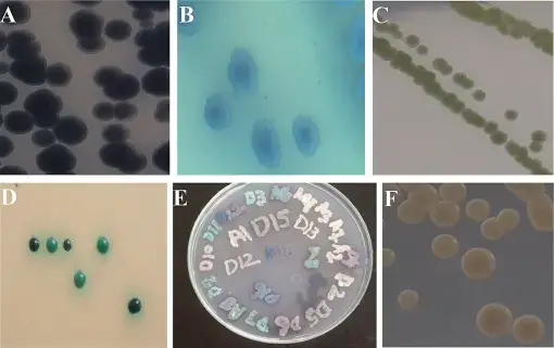 (A) Candida tropicalis bluish purple colonies. (B) The appearance of C. tropicalis after 72 hours of incubation on CHROMagar at 37°C. (C) Apple green color colonies of Candida albicans grown for 48 hours on CHROMagar Candida at 37°C. (D) Isolated green color colonies of C. albicans grown for 48 hours on CHROMagar Candida at 37°C. (E) Direct plating of sample on CHROMagar Candida for 48 hours at 37°C. Mix colonies of different species can also seen on this plate. (F) Smooth pink colonies of Candida glabrata grown for 48 hours on CHROMagar Candida at 37°C.
