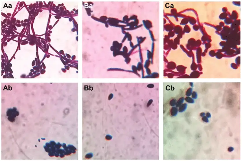 Morphology of C. albicans and C. tropicalis in the control and the test groups under OM observation. (Aa) C. albicans, 12 h; (Ab) intracellular protein-treated C. albicans, 12 h. (Ba) C. tropicalis, 12 h; (Bb) intracellular protein-treated C. tropicalis, 12 h. (Ca) C. albicans and C. tropicalis co-culture, 12 h; (Cb) intracellular protein-treated co-culture, 12 h. Magnification, x1,000. C. albicans, Candida albicans; C. tropicalis, Candida tropicalis; OM, optical microscopy.
