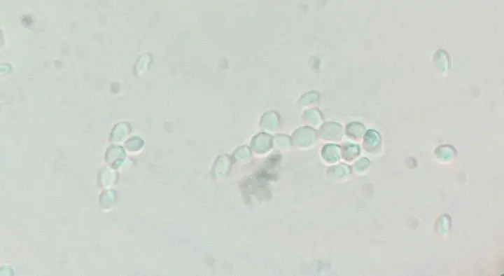 Microscopic examination of filamentous growth in C. glabrata (ATCC 90030); the most cell aggregation and branching pseudohyphal cells at 10% CO2 pressure after 72 h
