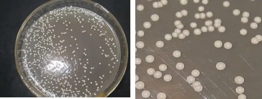 Candida parapsilosis- Pink colored colonies on Hicrome agar
