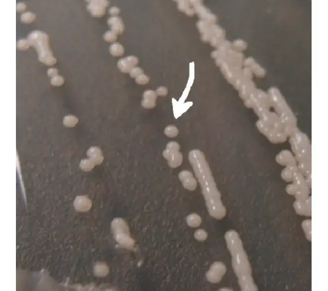 Image of Candida parapsilosis colonies cultivated on agar for 48 h (the arrow shows selected colony for Raman analysis). The colony size is about 2 mm
