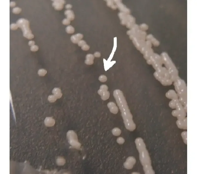 Image of Candida parapsilosis colonies cultivated on agar for 48 h (the arrow shows selected colony for Raman analysis). The colony size is about 2 mm
