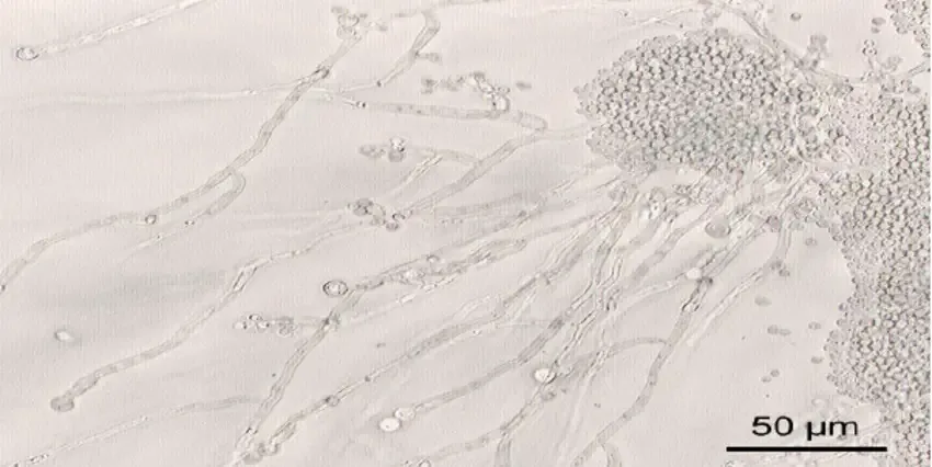 “Candida parapsilosis pseudohyphae and spores detected in blood culture.” Table 6 . “First time serological detection of Candida species in blood.”
