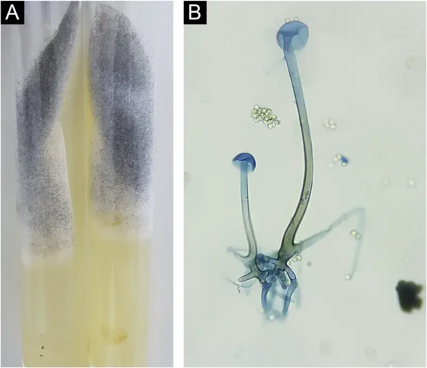 Rhizopus microsporus. (A), Colony consisting of whitish ”cotton-wool” mycelium and blackish granular aerial mycelium. (B), Microculture showing coenocytic hypha with rhizoids, sporangiophore and empty sporangia. The presence of sporangiospores is observed around the structure (Cotton blue, ×400).
