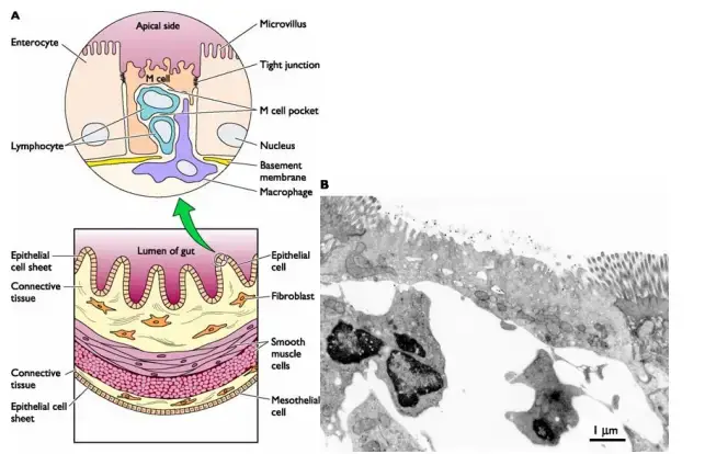 Viral entry in the intestine through M cells.
