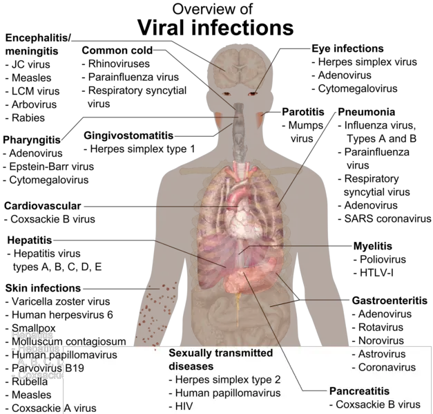 Overview of the main manifestations of viral infection