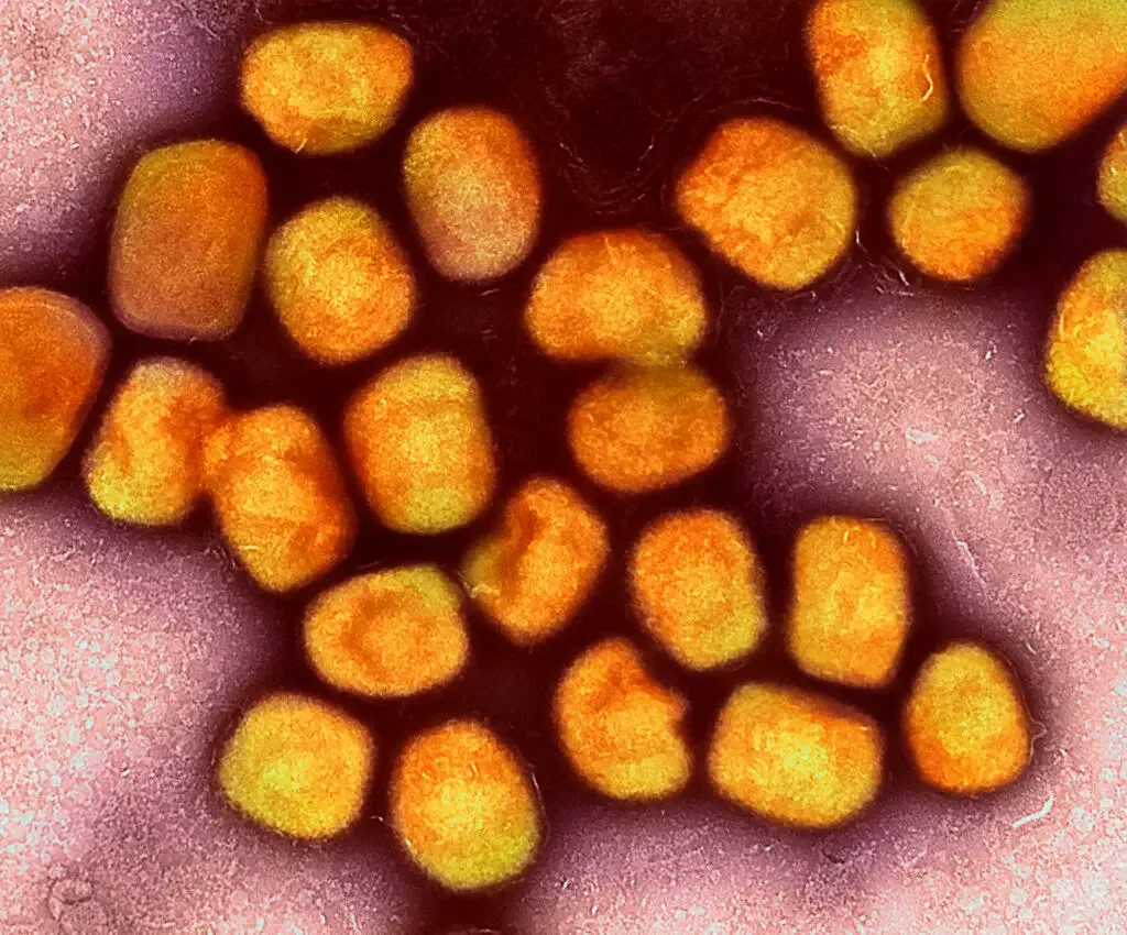Colorized transmission electron micrograph of monkeypox virus particles (gold) cultivated and purified from cell culture. Image captured at the NIAID Integrated Research Facility (IRF) in Fort Detrick, Maryland. Credit: NIAID
