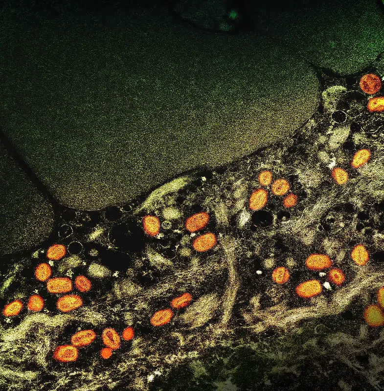Colorized transmission electron micrograph of monkeypox particles (orange) found within an infected cell (brown), cultured in the laboratory. Image captured at the NIAID Integrated Research Facility (IRF) in Fort Detrick, Maryland. Credit: NIAID