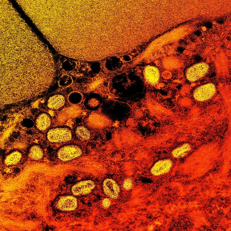 Monkeypox virus pics – Colorized transmission electron micrograph of monkeypox particles (yellow) found within an infected cell (red), cultured in the laboratory. Image captured at the NIAID Integrated Research Facility (IRF) in Fort Detrick, Maryland. Credit: NIAID
