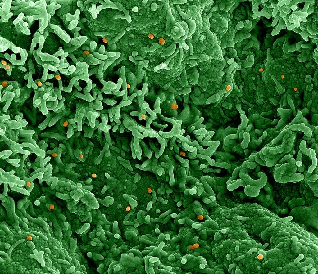 Monkeypox virus pics – Colorized scanning electron micrograph of monkeypox virus (orange) on the surface of infected VERO E6 cells (green). Image captured at the NIAID Integrated Research Facility (IRF) in Fort Detrick, Maryland. Credit: NIAID

