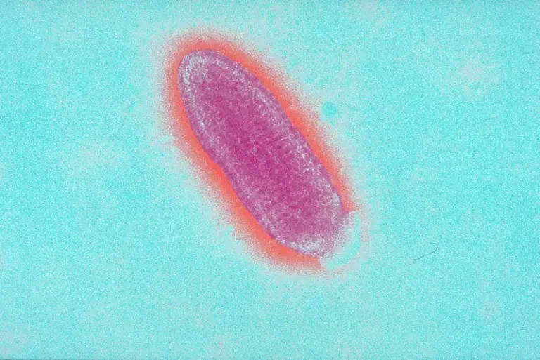 Rabies Virus - Structure, Genome Organization, Pathogenesis ...