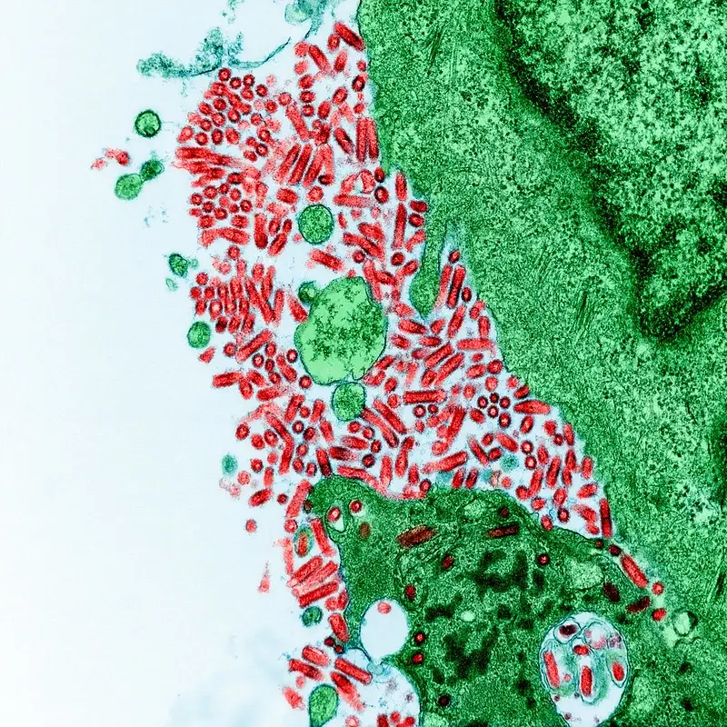 rabies virus image – Colorized transmission electron micrograph of Rabies virus (red), which has heavily infected hamster kidney cells (green) cultured in the lab. Image captured and color-enhanced at the NIAID Integrated Research Facility (IRF) in Fort Detrick, Maryland. Credit: NIAID
