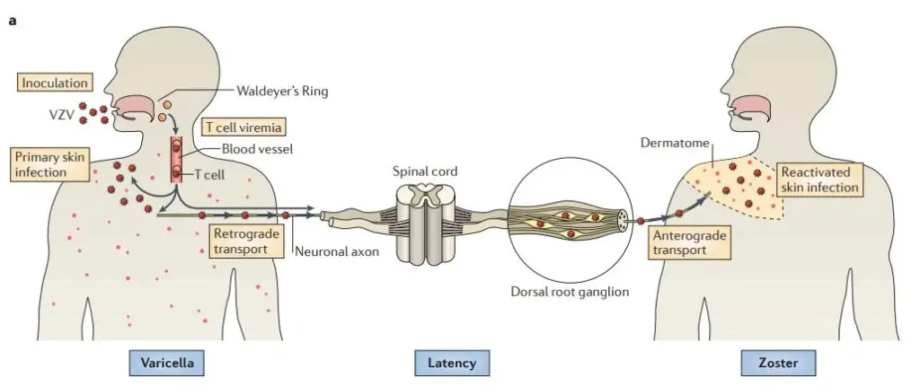 Replication and Life cycle of Varicella Zoster Virus
