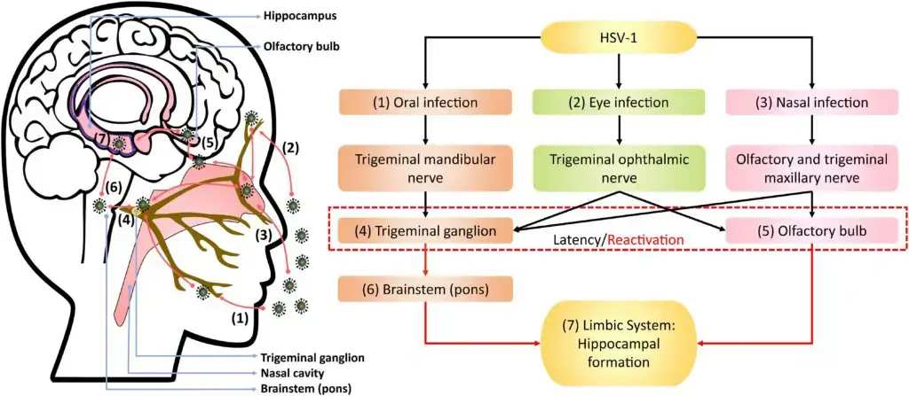 Clinical manifestations of Herpes simplex virus 1 (HSV-1)