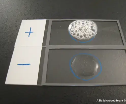 Slide Method of Catalase Test