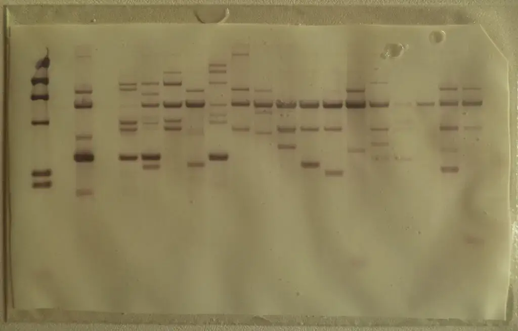 Southern blot membrane after hybridization and rinsing. 