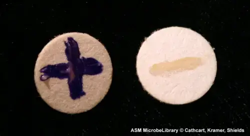 On the left is oxidase-positive Pseudomonas aeruginosa and on the right is oxidase-negative Escherichiacoli. Both organisms were rubbed on a filter that had been dipped in Kovács oxidase reagent and allowed to dry.