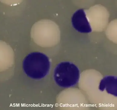 This is a mixed culture of oxidase-negative Escherichia coli and oxidase-positive Vibrio cholerae showing how the direct oxidase test differentiates between the two organisms. Kovács oxidase reagent was added directly to the plate. 